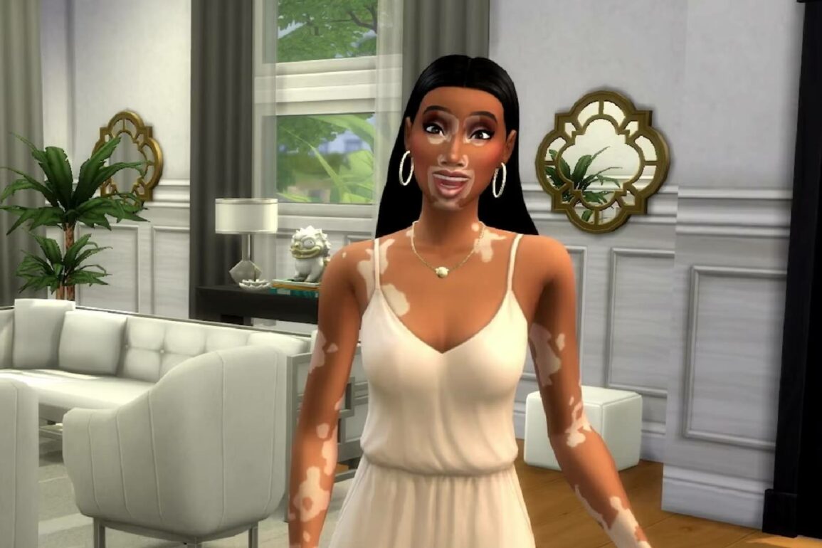 The Sims 4 to Introduce Vitiligo Skin Feature and Winnie Harlow Partnership