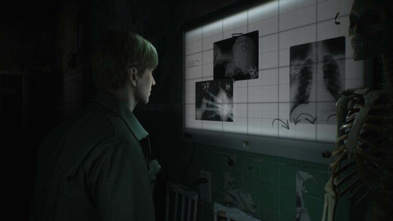 Silent Hill 2 examining photos on wall